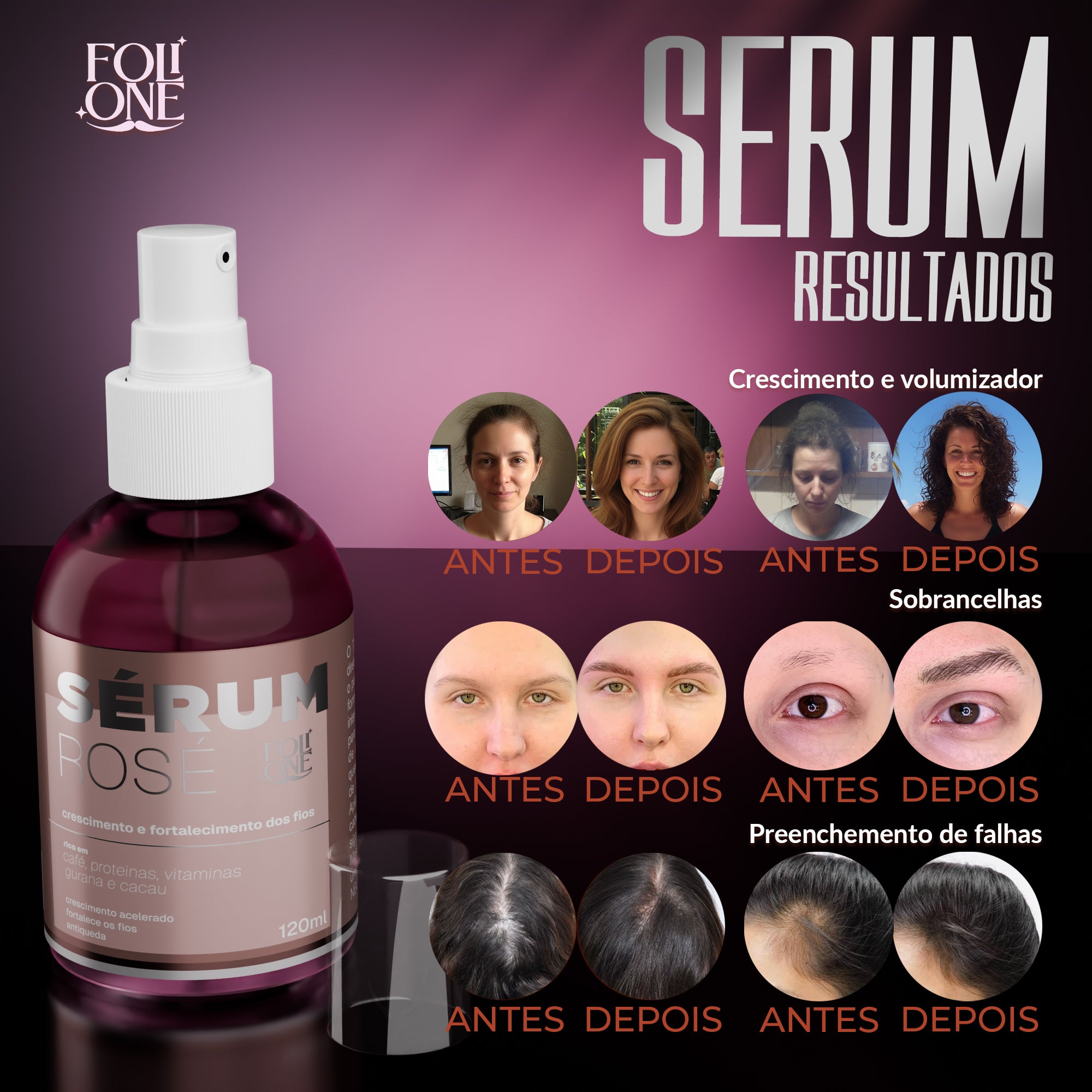 Kit Rosé Shampoo 300ml  com Sérum 120ml